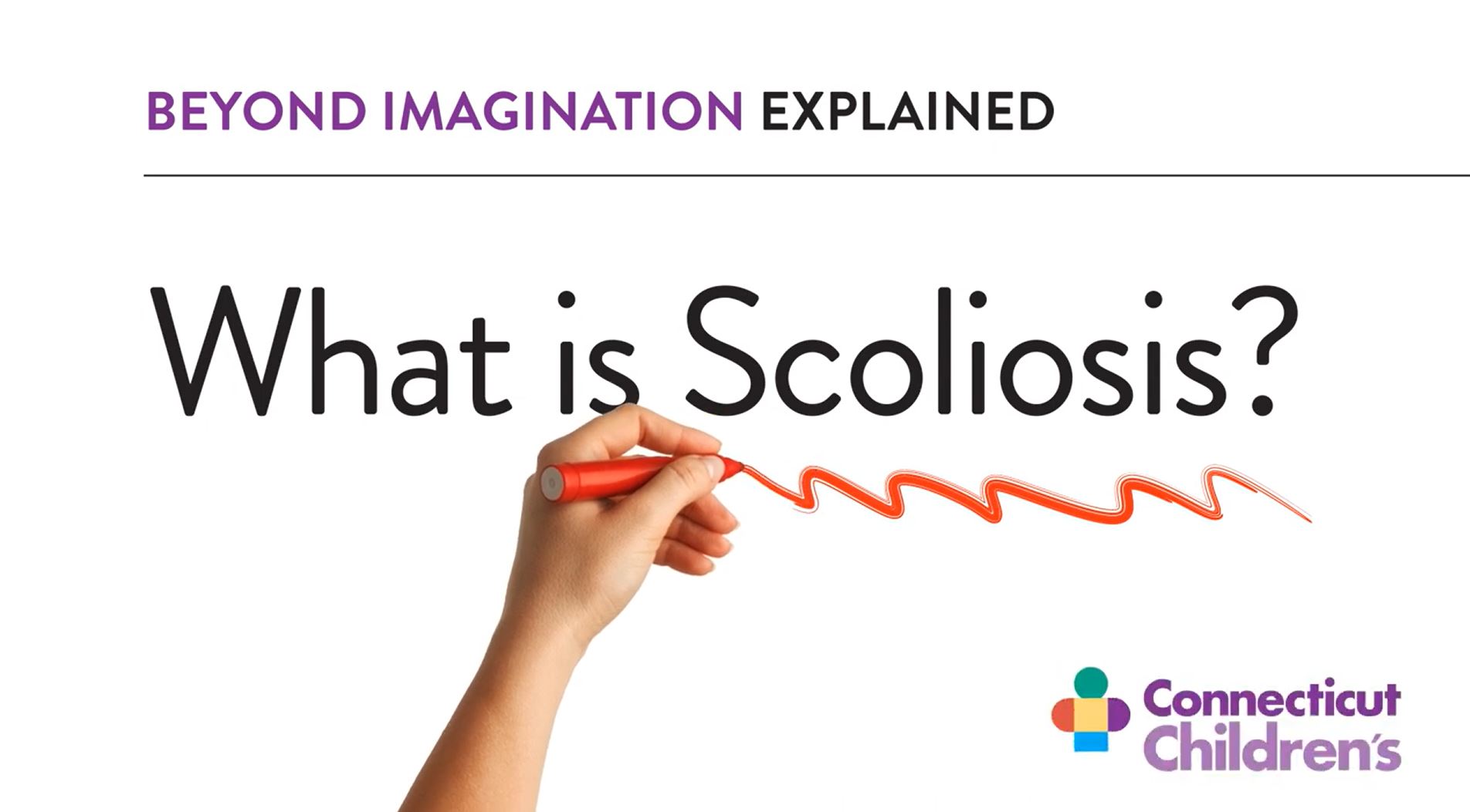 What is Scoliosis? Video Screengrab