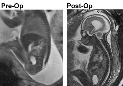 An ultrasound