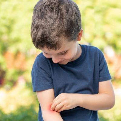 Young boy itching mosquito bite on arm. 